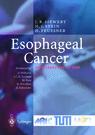 Esophageal Cancer